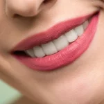 Das Bild zeigt eine Frau, die keine weißen Flecken auf den Zähnen hat.